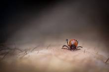 tick embedded in skin